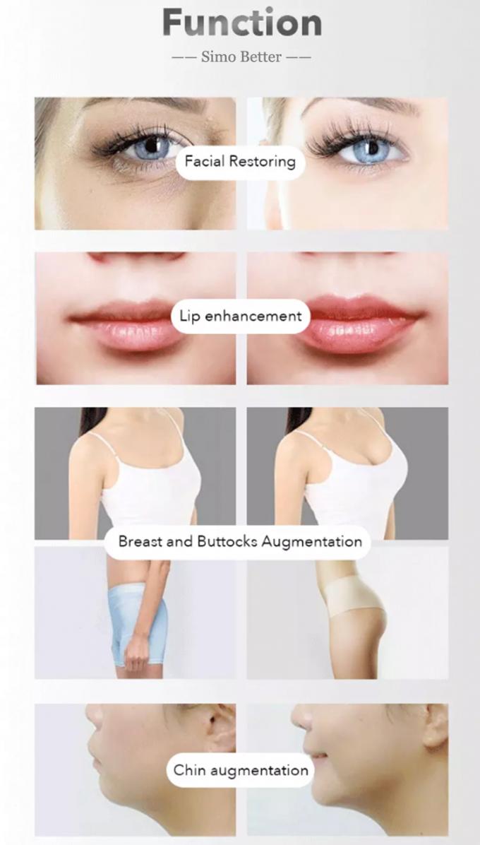 HA 입술 증가를 위한 안정되어 있는 입술 증진 충전물 주사 가능한 피부 충전물
