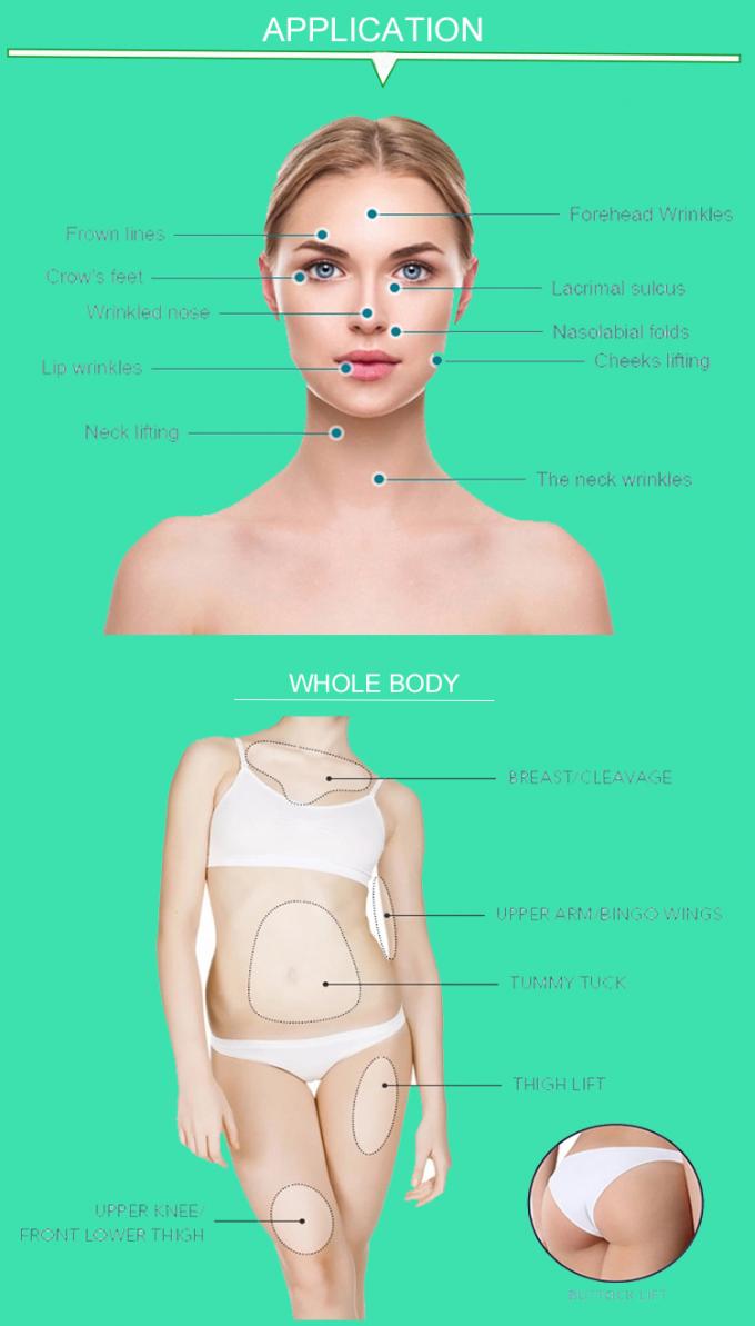 단청 실 상승 안전 나이 드는 피부를 위한 외과 Pdo 봉합사를 형성하는 얼굴